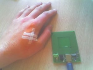 Rfid_implant_after